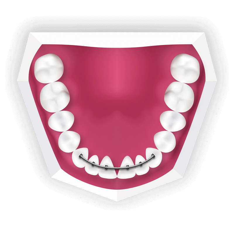 braces near me kids orthodontist